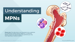Understanding MPNs